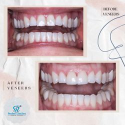 Perfect Smiles Dental Studio - Before & After Venners