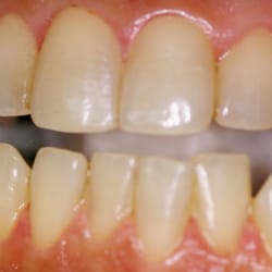 J Timothy Modic, DDS - Before Whitening