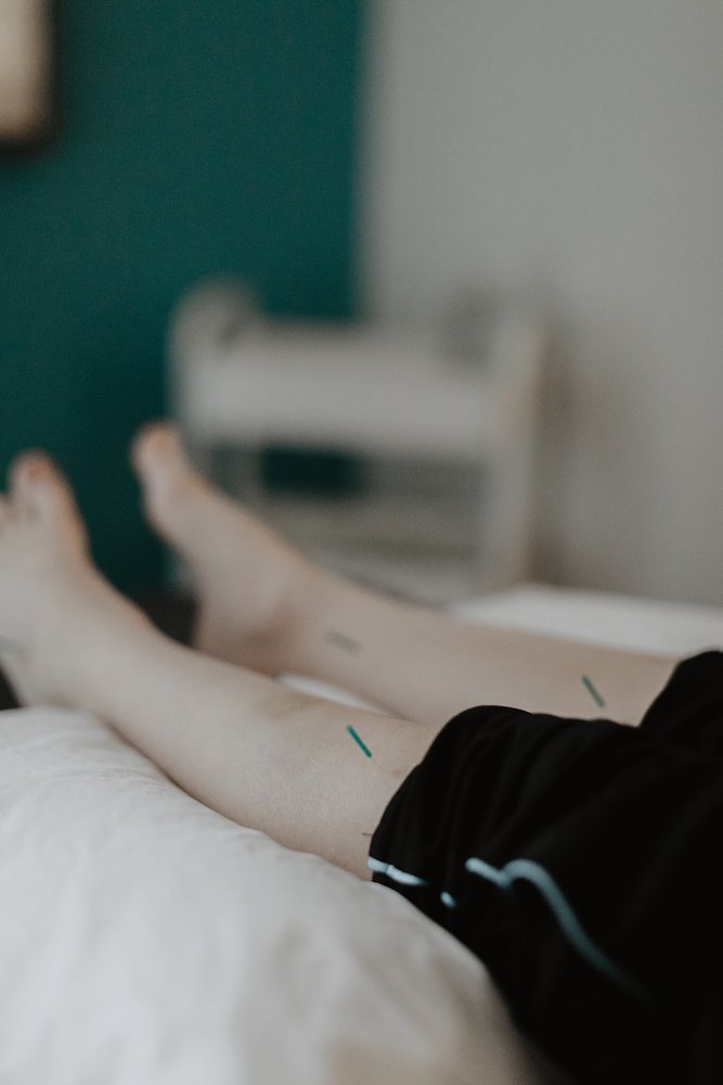 NEW DAY ACUPUNCTURE Updated September 2024 1092 Lexington Ave