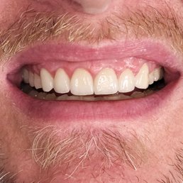 My new smile after dental work! My new smile after dental work!