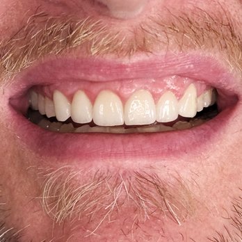 Baseline Dental Practice - My new smile after dental work! - Orthodontists Near Me - Rancho Cucamonga, California Baseline Dental Practice - My new smile after dental work! - Orthodontists Near Me - Rancho Cucamonga, California