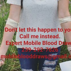 Expert Mobile Blood Draws - Don't let this happen to you! Call me instead!