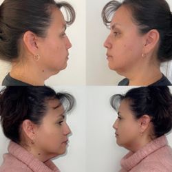 Aesthetic Contouring By Mina