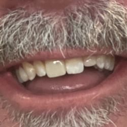 Detail Dental - YAY!