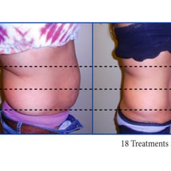 Weight Loss Rockville