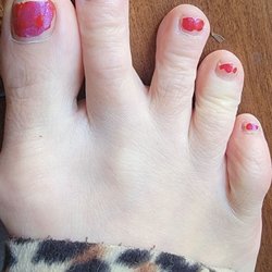 Knapik Steven DO - This is what Stephen Knapik and his PA Joyce call a perfectly normal foot