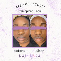 Kaminska Dermatology