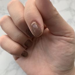 Badly cut cuticle