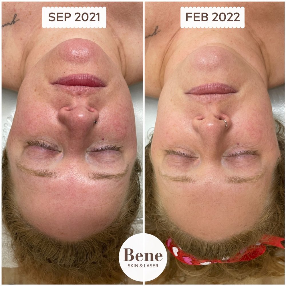 Bene Skin & Laser Logo