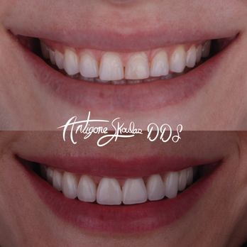 Skoulas, DDS - Cosmetic Dentists Near Me - San Francisco, California