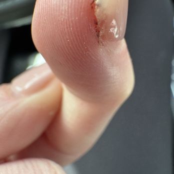 May Nails & Spa - The ripped skin blood under the fake nail - Nail Salons Near Me - Yukon, Oklahoma May Nails & Spa - The ripped skin blood under the fake nail - Nail Salons Near Me - Yukon, Oklahoma