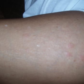 Palm Beach Tan - Manager did not care he said I tanned there before. Wow...very cocky response..Many people go thru the beds being there b4 means nothing. :( - Skin Care Near Me - Petaluma, California