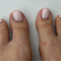 Terrible pedicure.
