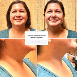 Saenz Medical Massage Therapy - Mobility conditioning for neck pain not only translates to reducing pain it also increases strength to neck soft-tissues.