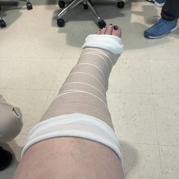 Overlake Medical Center - Broken ankle and foot - Hospitals Near Me - Bellevue, Washington Overlake Medical Center - Broken ankle and foot - Hospitals Near Me - Bellevue, Washington
