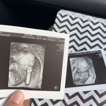 Baby Bump Studios - You can actually see him! - Diagnostic Imaging Near Me - Ontario, California Baby Bump Studios - You can actually see him! - Diagnostic Imaging Near Me - Ontario, California