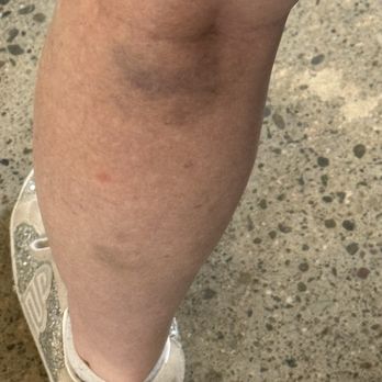 Oracle Park - My moms legs after the concert - Stadiums & Arenas Near Me - San Francisco, California