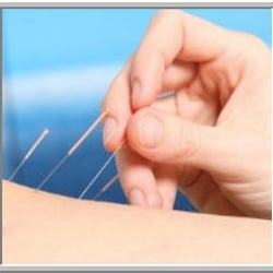 Acupuncture Wellness Roslyn, PC