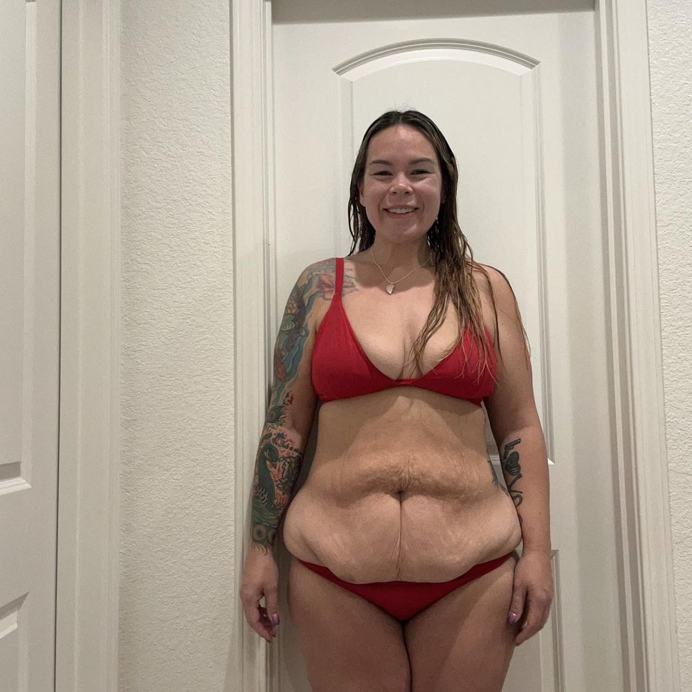 TOP 10 BEST Plastic Surgery in Vacaville, CA - Updated 2026 - Yelp