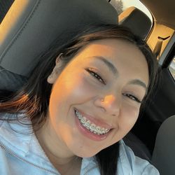 Nolan Smiles Orthodontics - During braces