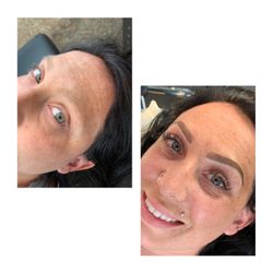 Beauty By America - Microshaded eyebrows before and after