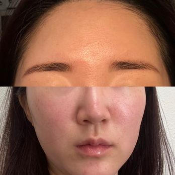 Skincare by RK - The most recent my skin condition! - Skin Care Near Me - Brea, California Skincare by RK - The most recent my skin condition! - Skin Care Near Me - Brea, California