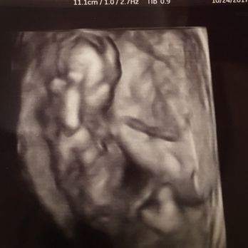 Inside View 3D/4D Ultrasound - 16 weeks. 3D - Diagnostic Imaging Near Me - Lacey, Washington