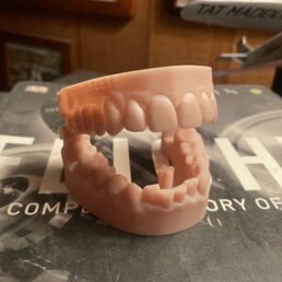 Dr. Jaber's exact copy of my teeth. Dr. Jaber's exact copy of my teeth.
