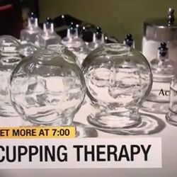 Fort Myers Acupuncture & Massage - Cupping Therapy