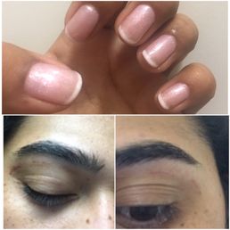 Not satisfied, skin around my eyes was damaged