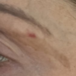 Ceci Nail&Spa - Few days after and still healing.