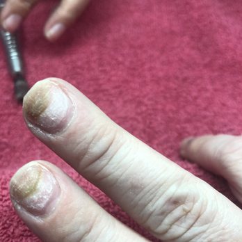 Party Nails and Spa - Fungus on my nail - Nail Salons Near Me - Monroe, North Carolina