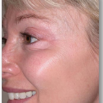 Youthful Image - Medical Spas Near Me - Edmonton, Alberta Youthful Image - Medical Spas Near Me - Edmonton, Alberta