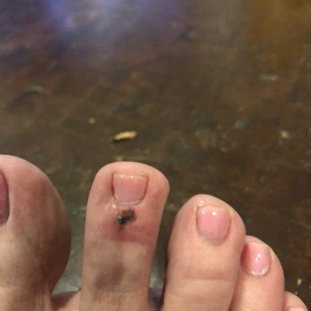 Palace Nails & Spa - May as well not get a pedicure if this is the outcome. - Waxing Near Me - Lewisville, Texas