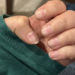 gel x nails poorly removed
