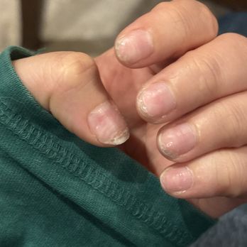 Pinnacle Nails & Spa - gel x nails poorly removed - Nail Salons Near Me - Scottsdale, Arizona