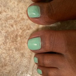 My big toes shouldn't look like this.!