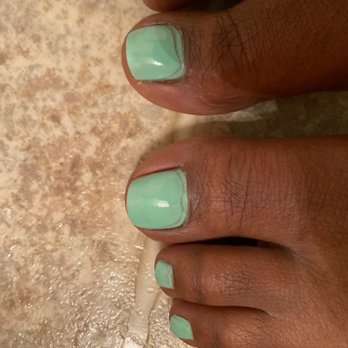 City Nails & Spa - My big toes shouldn't look like this.! - Nail Salons Near Me - Gainesville, Georgia