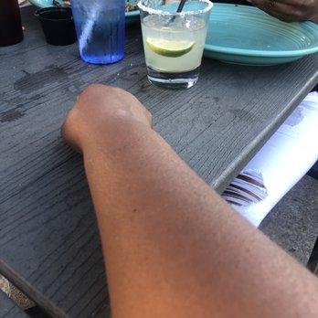 Fire + Ice - A different kind of Nat lands right on my arm - New American Near Me - Anaheim, California