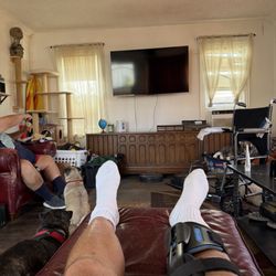 Allan Delman, M.D - Leg is getting better 