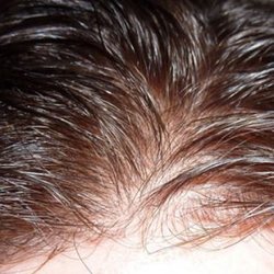 Natural looking hair