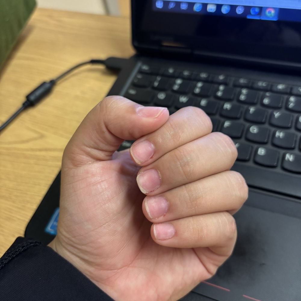 Pristine Nails and Spa at Millenia - Cut up fingers - Nail Salons Near Me - Orlando, Florida Pristine Nails and Spa at Millenia - Cut up fingers - Nail Salons Near Me - Orlando, Florida