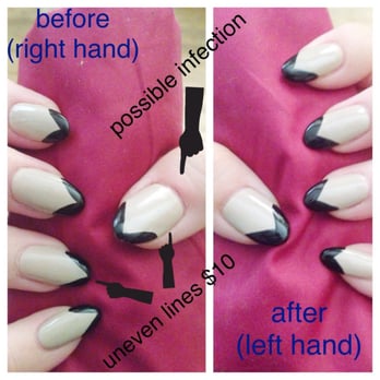 Concept Nail Spa - Before: messy lines,cut my cuticles, redness near my thumb After: other hand, I fixed black tips at home & I'm not even a pro - Nail Salons Near Me - Northbrook, Illinois
