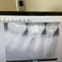 EndoArt - Problem identified