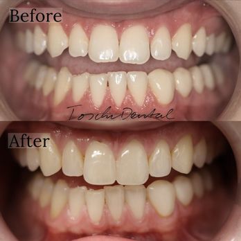 Toschi Dental: Steven M. Toschi, DDS and Jeffery Toschi, DMD - General Dentistry Near Me - San Jose, California Toschi Dental: Steven M. Toschi, DDS and Jeffery Toschi, DMD - General Dentistry Near Me - San Jose, California