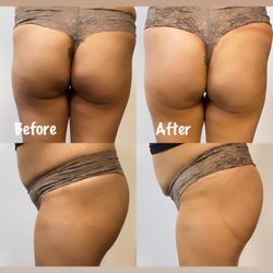 Janie’s Body Sculpting