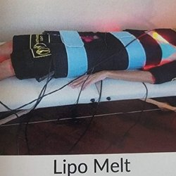 Revive Body Contouring
