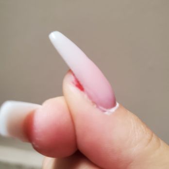 Kendall Nails Salon - thumb cut deep and blood coming out 2nd day - Nail Salons Near Me - San Bernardino, California
