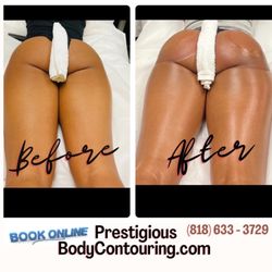 Prestigious Body Contouring
