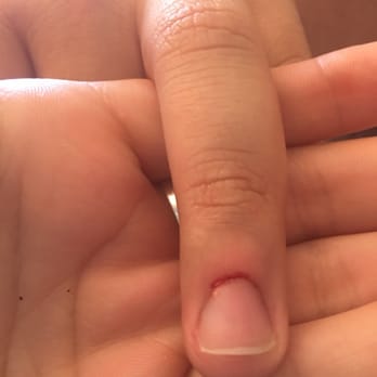 Myland Nails & Spa - CUTICLE COMPLETELY CUT OFF - Waxing Near Me - Davis, California